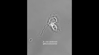Gorgeous cortical neuron with growth cone, ensheathed by oligodendrocyte  Lila Landowski