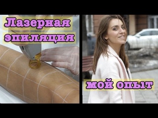 Эпиляция ЛАЗЕРОМ | вся информация и мой опыт | BlushSupreme