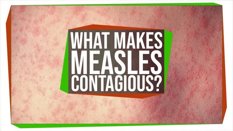 Why Is The Measles Virus So