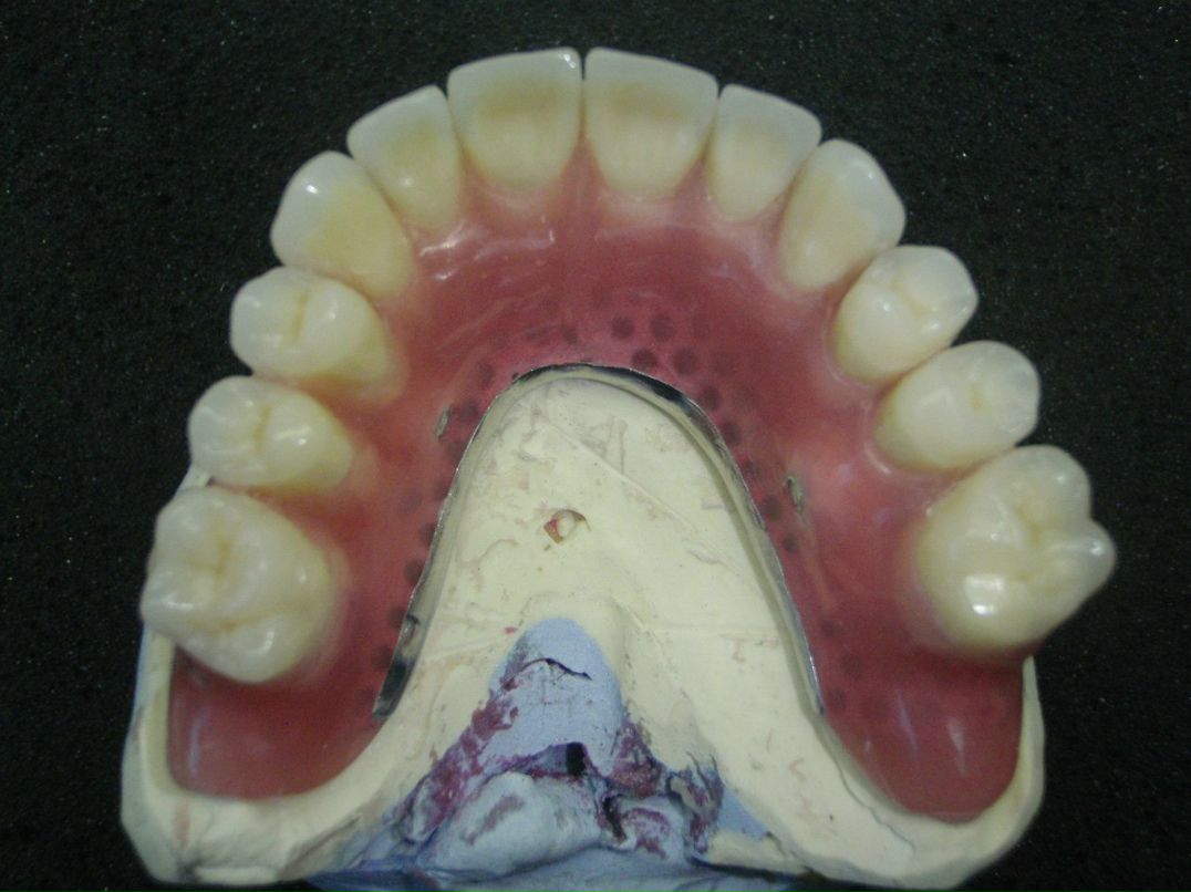 Эрнест Абрамян | Москва