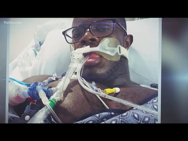 29 year old Georgia nurse, bodybuilder on ventilator for COVID 19