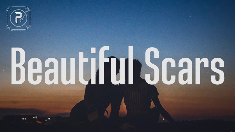 Maximillian Beautiful Scars (