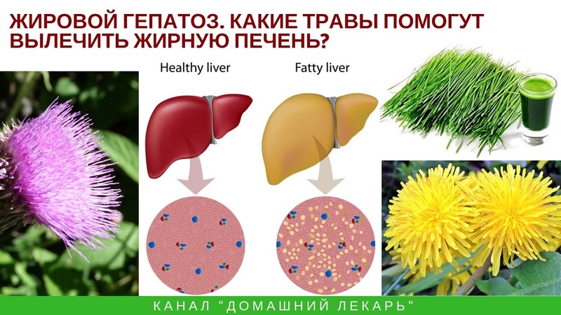 эффективное лекарство для печени жировой гепатоз. травы от гепатоза печени. гепатрин детокс эвалар. гепатоз печени лечение травами. гепатоз печени лечение травами.