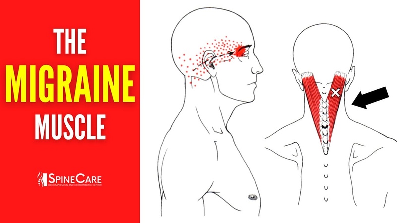 How to Release Tension for FAST MIGRAINE